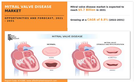 Mitral Valve Disease Market Size, Share | Forecast- 2031