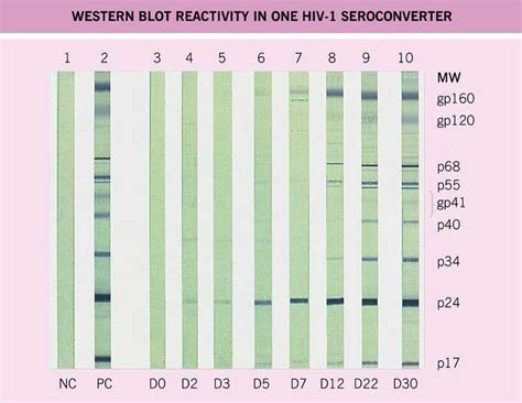 Basic western blotting procedure in reference to HIV test