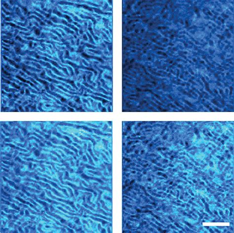 Second Harmonic Generation Microscopy: A Tool for Quantitative Analysis of Tissues | IntechOpen