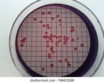 140 Salmonella Enterica Images, Stock Photos & Vectors | Shutterstock