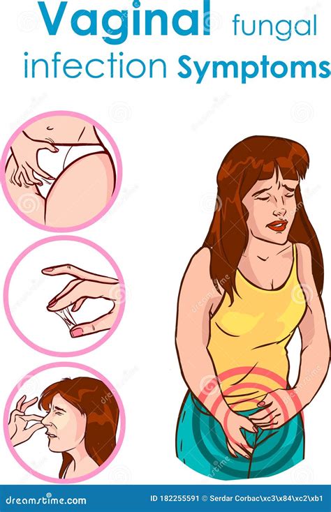 Vaginal Fungal Infection Symptoms Vector Illustration Stock Vector - Illustration of character ...