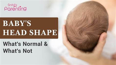 Baby's Head Shape - What's Normal and What's Not? - YouTube