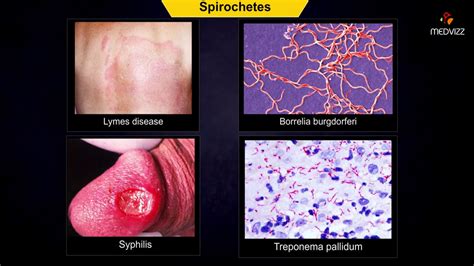 spirochetes microbiology - Animation - YouTube