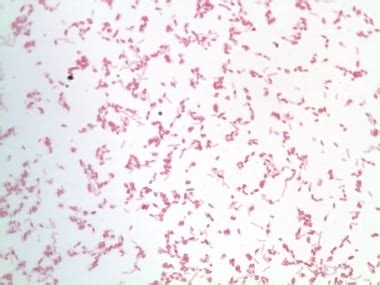 Gram Negative Rods And Gram Positive Cocci