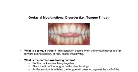 Clear Speech Therapy: Tongue Thrust