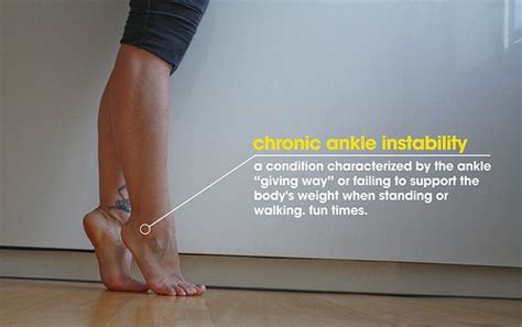 Ankle Instability: Treating Chronic Instability | PhysioFit Physical ...