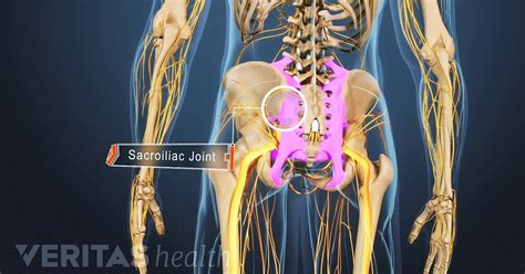 Ankylosing Spondylitis Surgery | Arthritis-Health