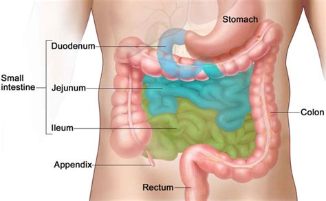 Bowel resection surgery, recovery, recovery time, diet & complications