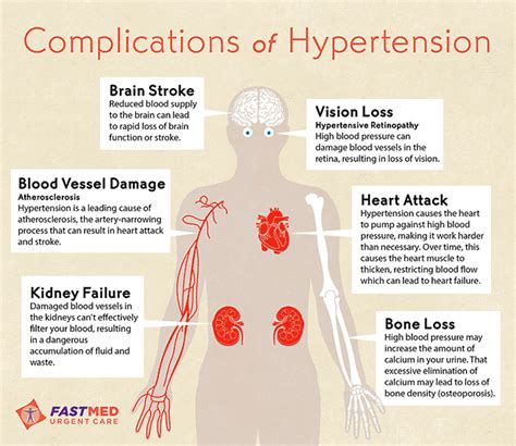 High Blood Pressure (Hypertension) - FastMed