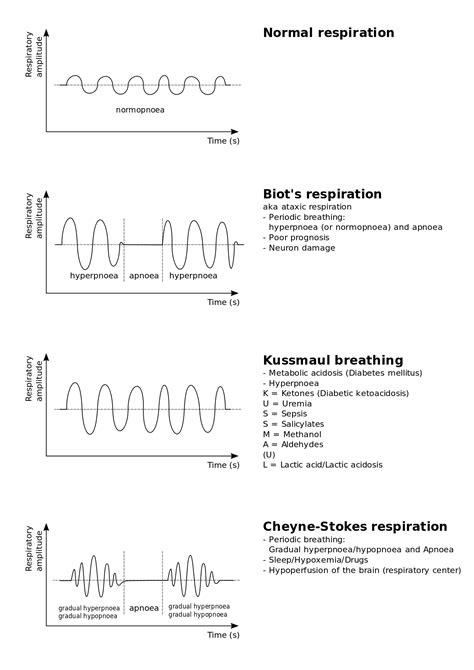 Kussmaul's Respirations Are Best Described as