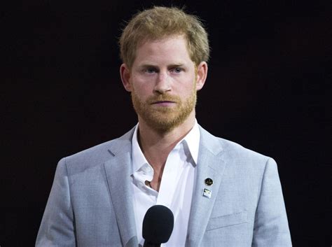 Prince Harry's Hair Loss Isn't Due To Stress, Expert Blames Prince Charles