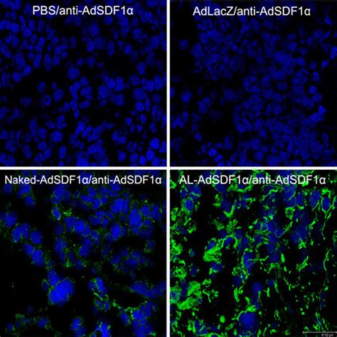 Characterization of the formulated Ad5-LacZ in vivo including LacZ gene... | Download Scientific ...