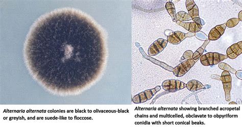 Alternaria alternata- An Overview