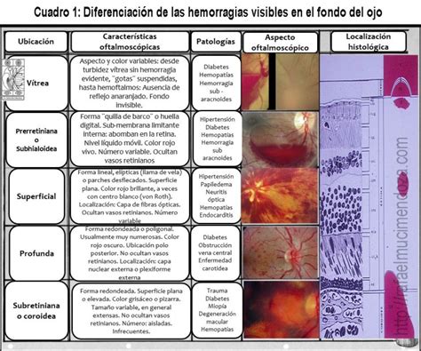 Tipos De Hemorragias Patologia Vs Diagnstico