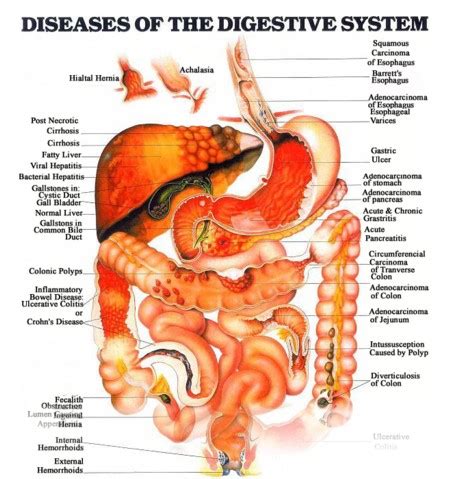 Digestive System Diagram ~ Digestive Diseases