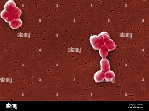 Acinetobacter Baumannii Gram Stain