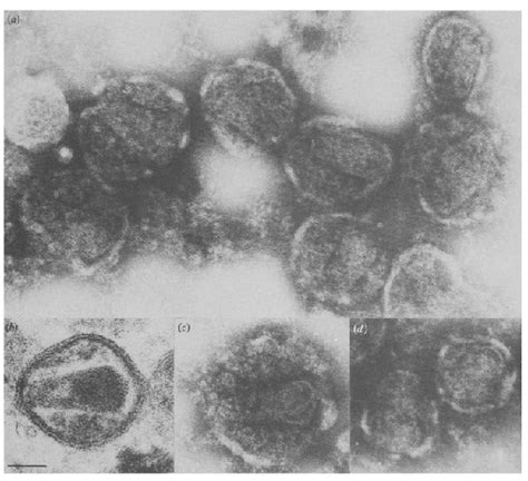 Electron Microscopy Hiv