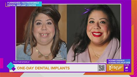 Sponsored: One Day Dental Implants Benefits | wfaa.com