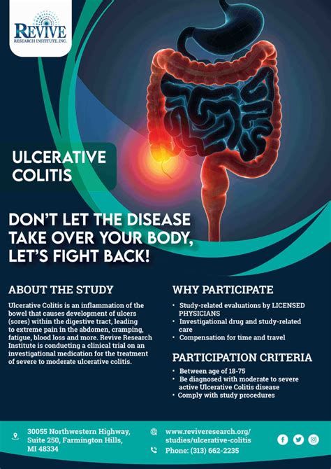 Ulcerative Colitis Clinical Trials - Ulcerative colitis treatment