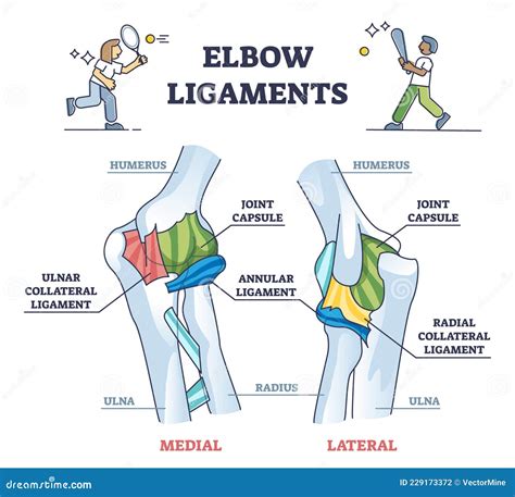 Elbow Ligaments with Medical Medial or Lateral Xray Structure Outline Diagram Stock Vector ...