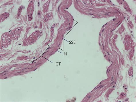 36 simple squamous epithelium labeled diagram - Wiring Diagram 2022