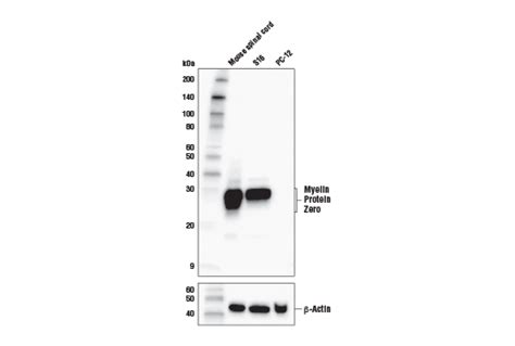 Myelin Protein Zero Antibody | Cell Signaling Technology