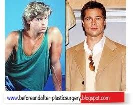 Brad Pitt before and after plastic surgery | Before and After Plastic ...