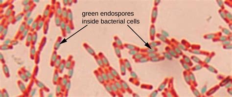 Staining Microscopic Specimens | Microbiology