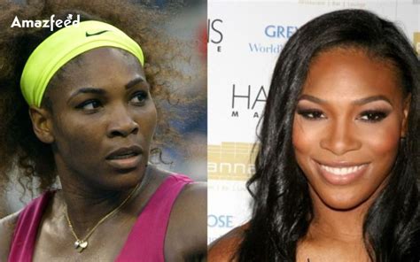 Serena Williams Plastic Surgery Before And After Look | Is Serena ...