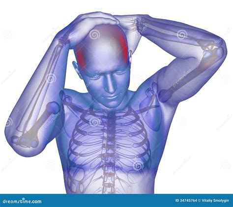 Body with visible headache stock illustration. Illustration of beauty - 34745764