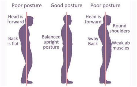 The Long-Term Effects of Bad Posture