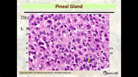 Pineal Gland Histology Labeled