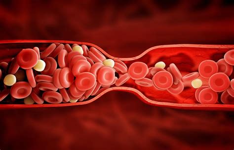 New Anti-Clotting Drugs Linked to Lower Risk of Serious Bleeding - Drug Discovery and Development