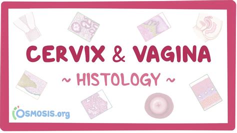 Cervix and vagina histology: Video & Anatomy | Osmosis