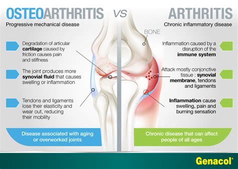 Arthritis or Osteoarthritis? - Good Times