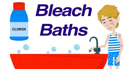 Bleach Baths for Recurrent Skin Infections - YouTube