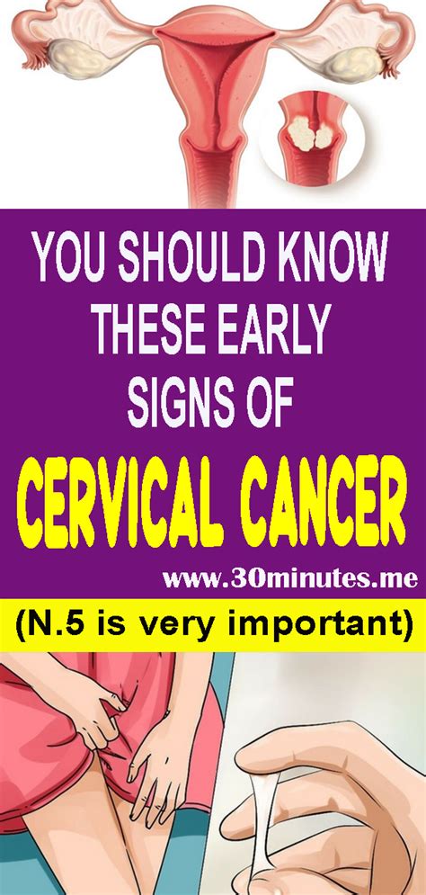 7 warning symptoms of cervical cancer that every women should know - HEALTH and WELLNESS