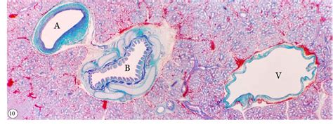 The caudal lobar pulmonary artery (A) and vein (V) ramifying along each ...