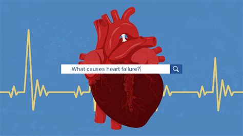 What is Heart Failure? A One-Minute Explainer > News > Yale Medicine