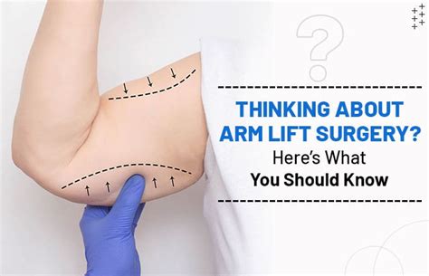 Thinking About Arm Lift Surgery? Here’s What You Should Know | Winston ...