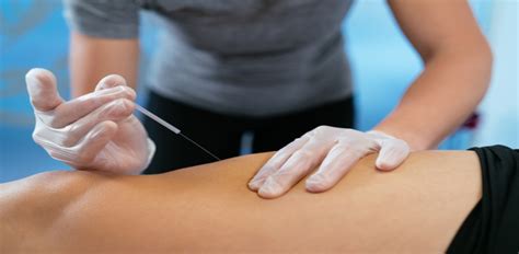 Exploring the 7 Different Types of Acupuncture Techniques - American ...