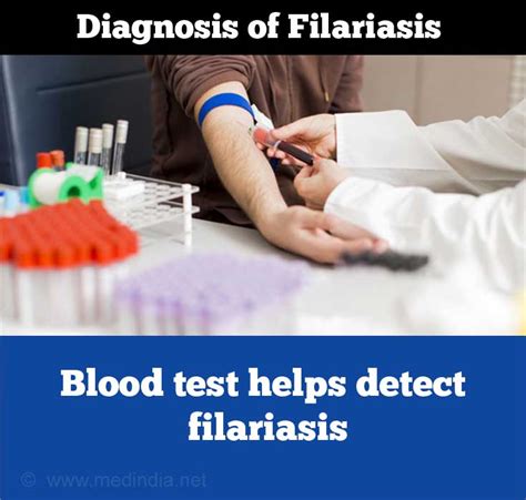 Diagnosis and Treatment of Filariasis