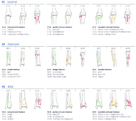 AO classification for tibia fractures (copyright AO Foundation.... | Download Scientific Diagram