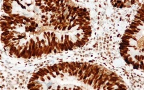 Immunocytochemistry (ICC) Protocol | Creative Bioarray