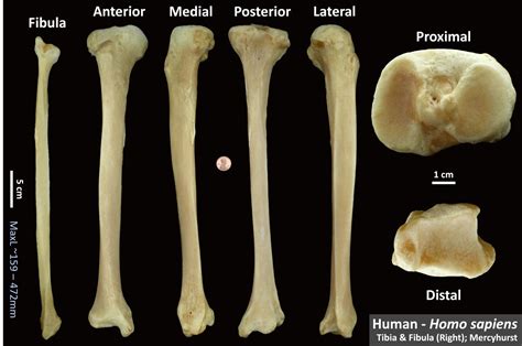 Human Tibia – OsteoID Bone Identification