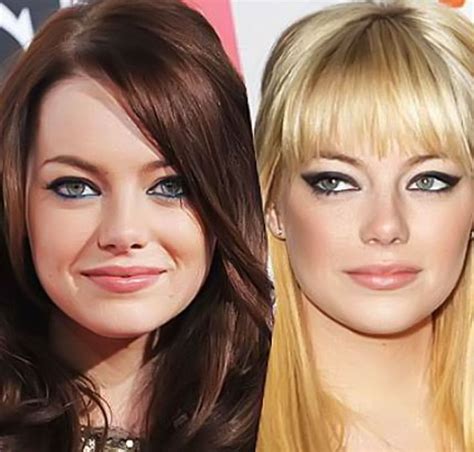 Emma Stone before and after plastic surgery 9 | Celebrity plastic surgery online