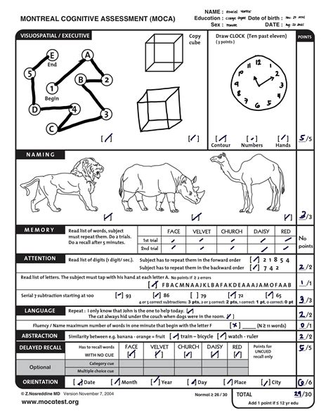 [Solved] Please administer the MOCA Test to a peer and then report the ...