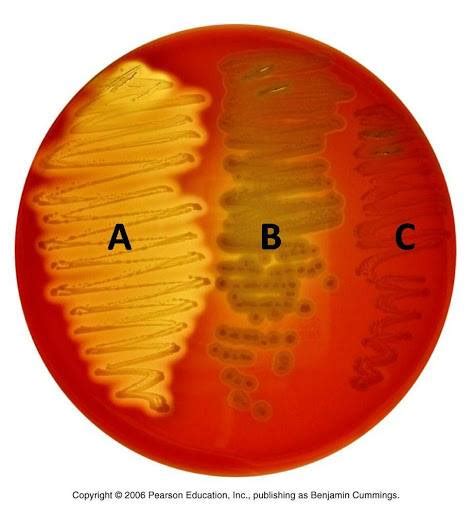 Blood Agar Alpha Beta Gamma