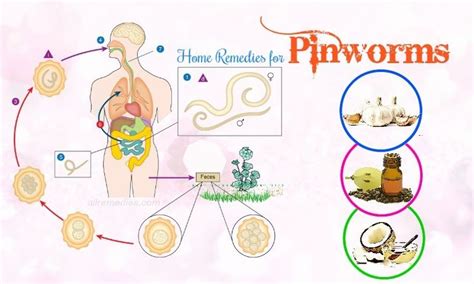 Pin by Christina Clark on Home Remedies | Home remedies for pinworms ...