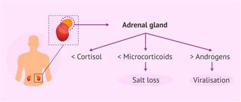 Pathophysiology of congenital adrenal hyperplasia